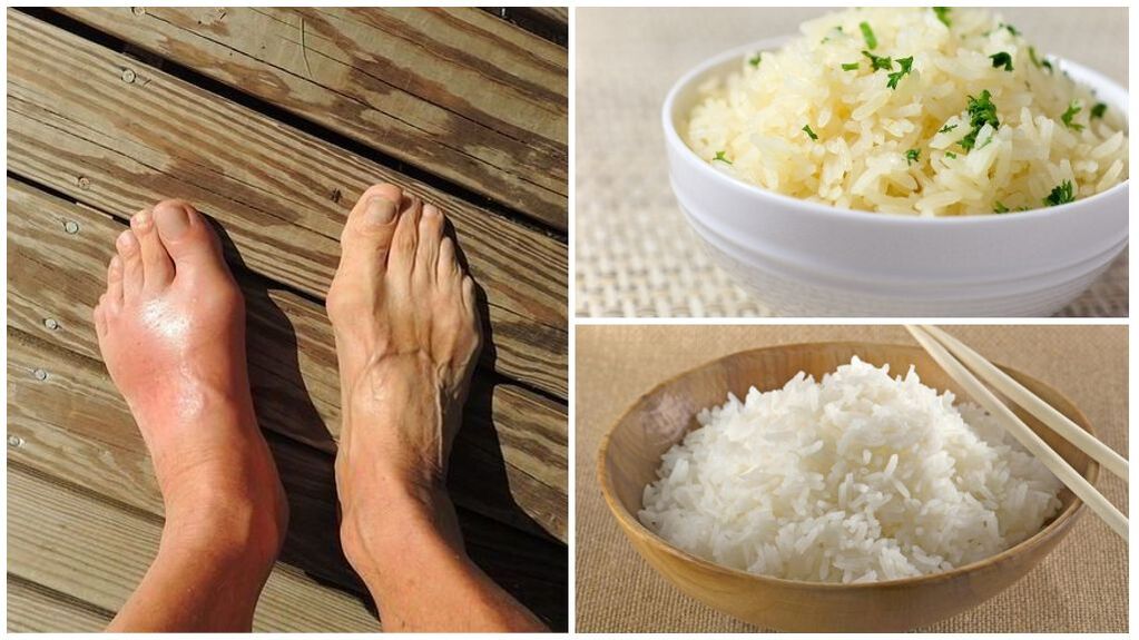 Un régime à base de riz est recommandé pour les patients goutteux. 